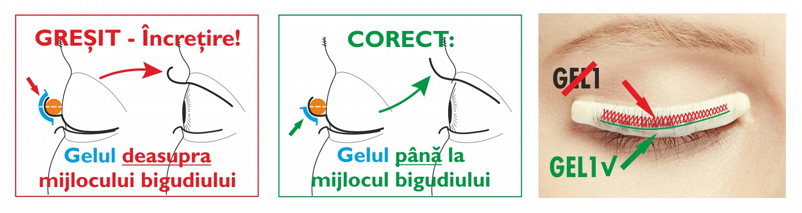 Lifting de gene CLASSIC Aplicarea gelului Lifting de gene CLASSIC Aplicarea gelului